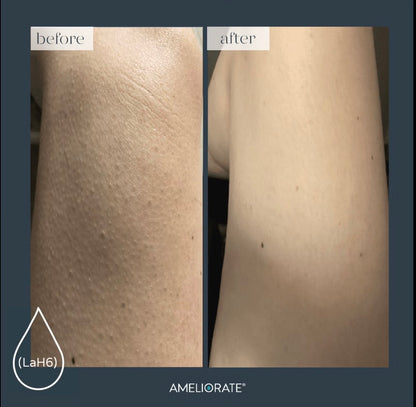 Ameliorate Transforming-Keratosis Pilaris Body Lotion 200ml